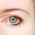 AN OVERVIEW OF GLAUCOMA