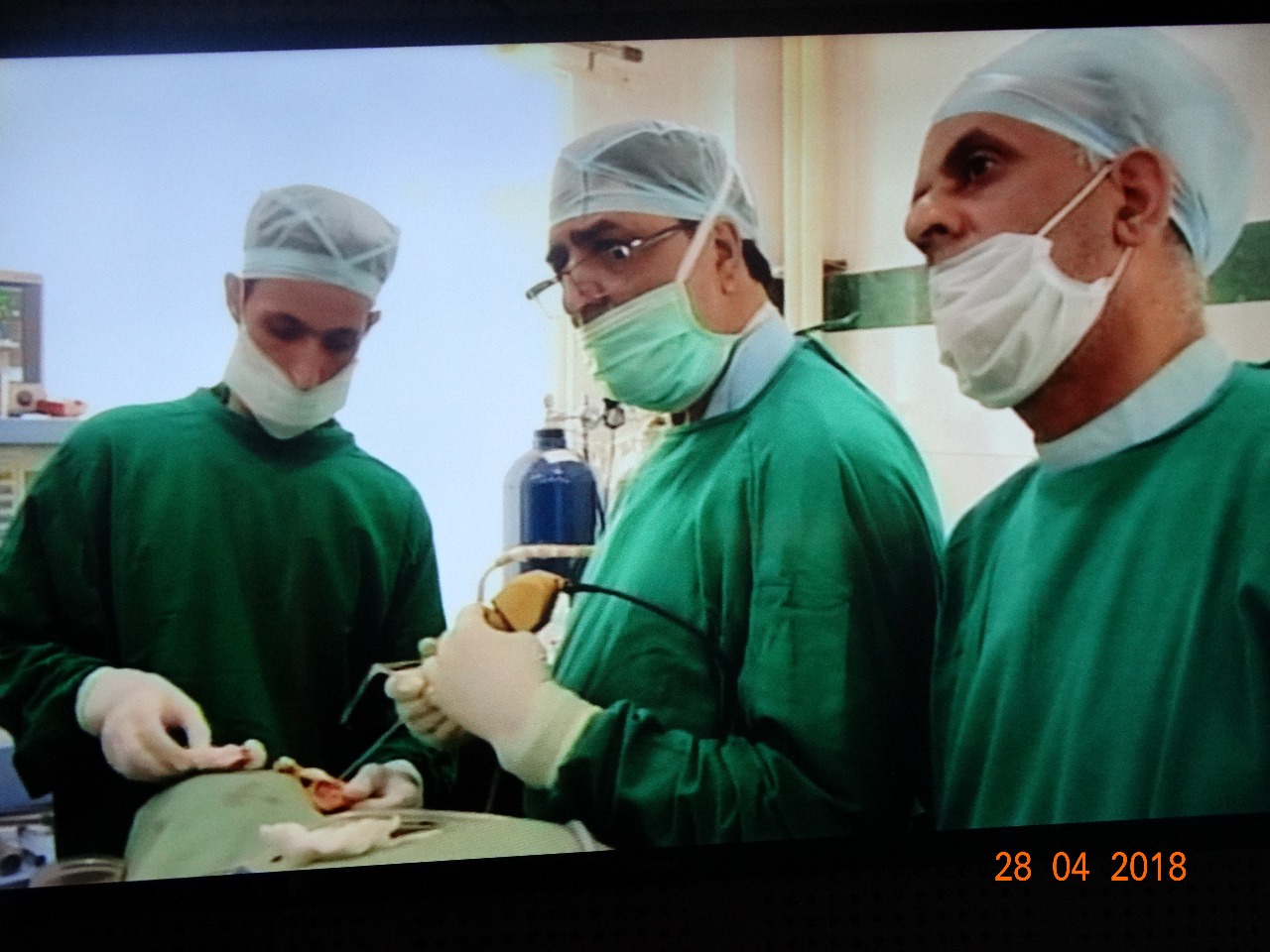 One day operative workshop on Rhinoplasty & basics of ENT held at Police Hospital Srinagar