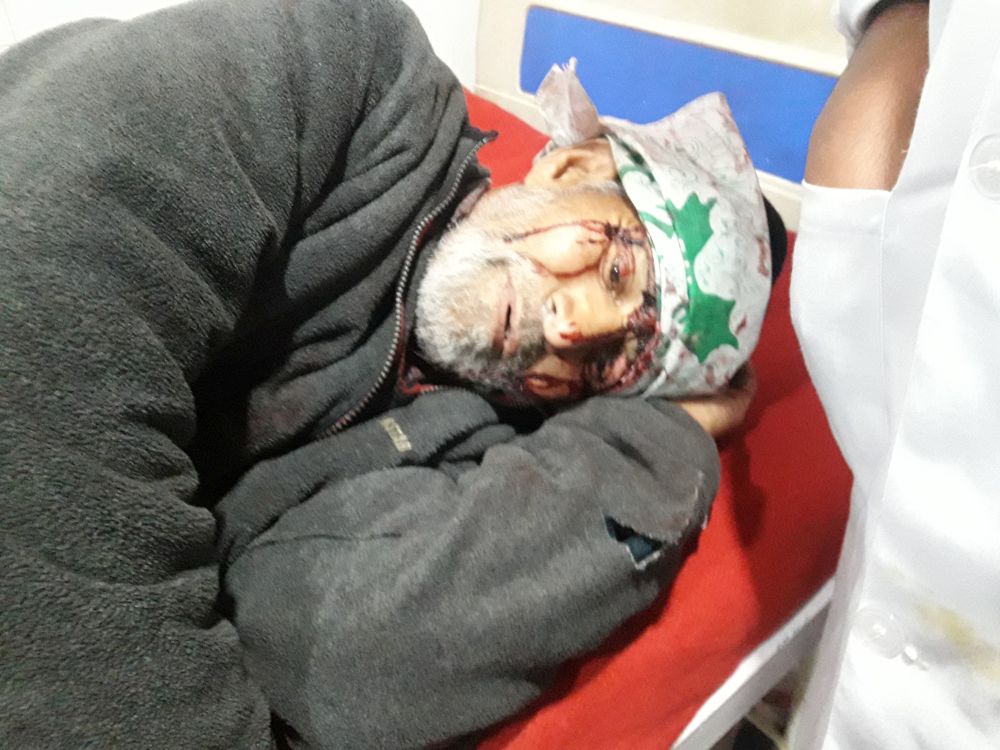 Bear mauls man in Tangmarg