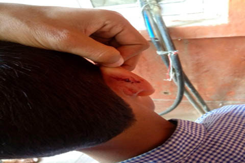 Student thrashed by teacher, hospitalized