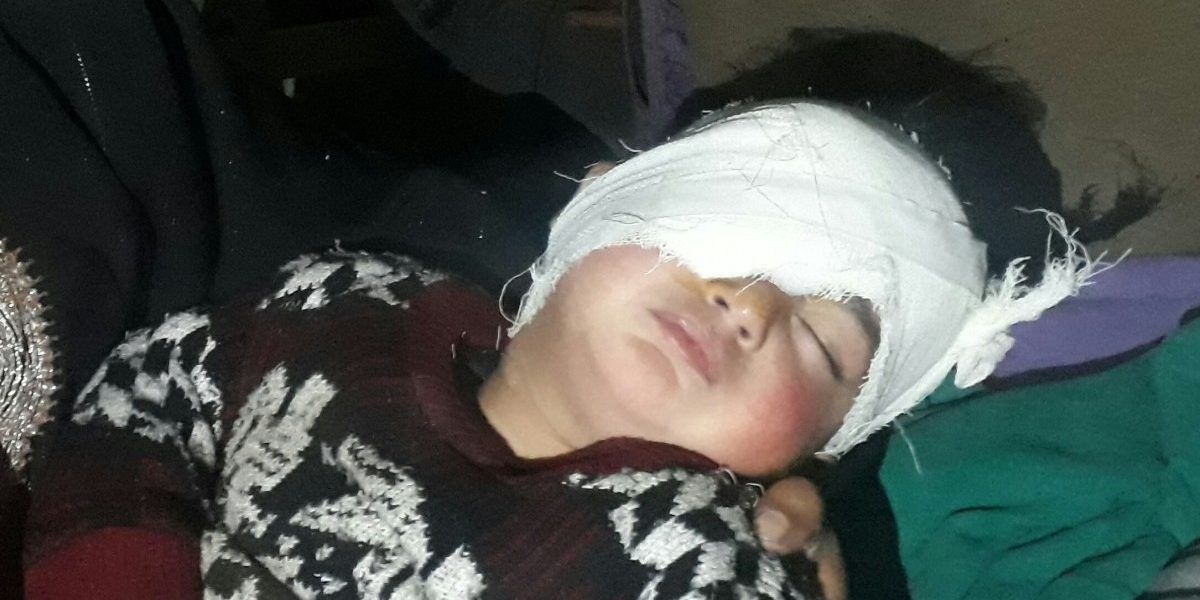 Pellet removed from Kashmir’s youngest victim’s eye