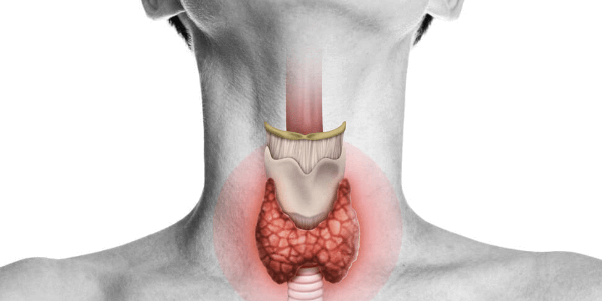 Thyroid: The Powerhouse Gland That Impacts Health and Metabolism
