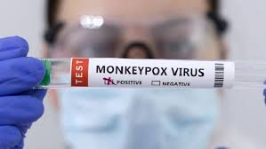 New mpox case confirmed; admitted at Delhi’s LNJP Hospital