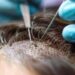 Lashkar terrorist goes for hair transplant after infiltrating J&K