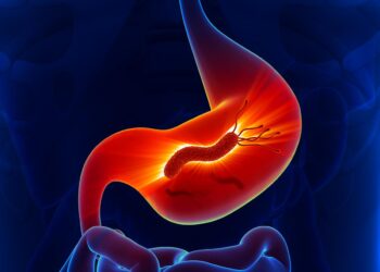 Eradicating H. pylori can prevent gastric cancer, says Nobel laureate Barry Marshall