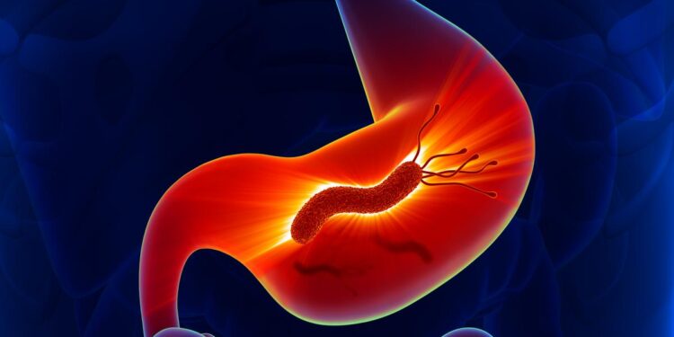 Eradicating H. pylori can prevent gastric cancer, says Nobel laureate Barry Marshall